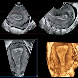 Ecografía 3D y Exploración