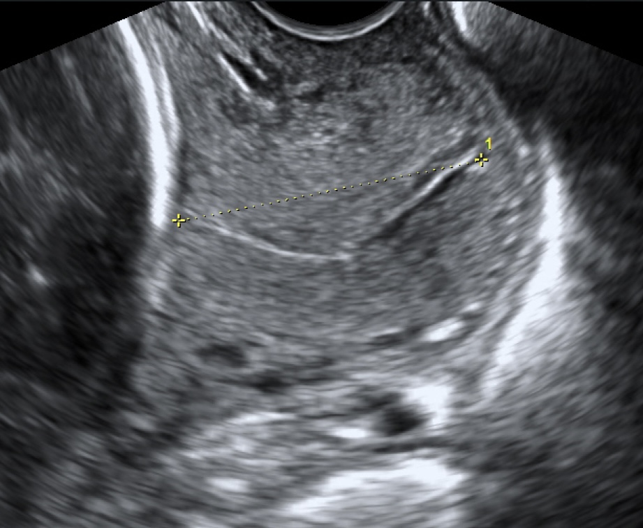 Cervicometría